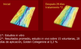 resultados