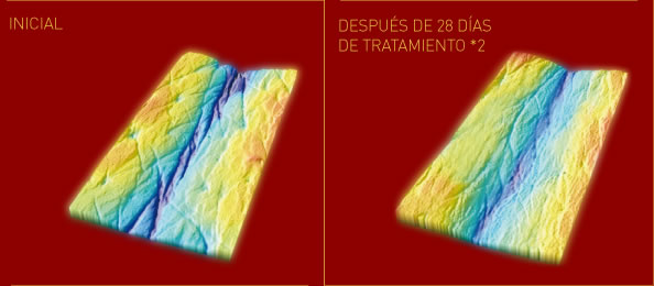 resultados